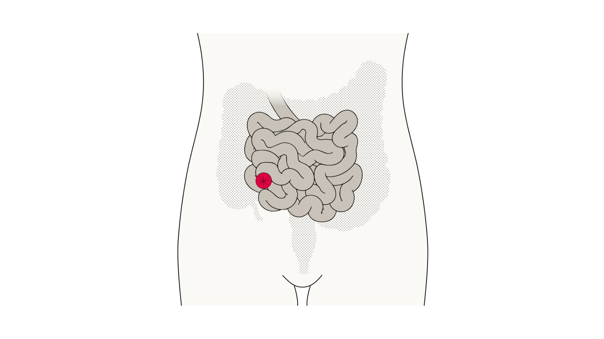 Imagens website ostomia - 2