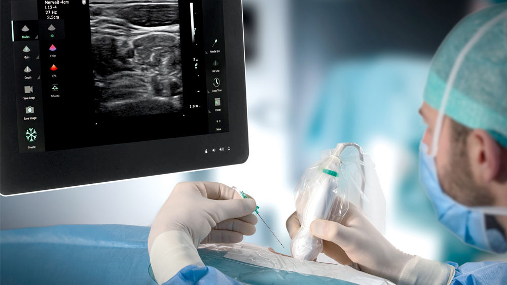 Anesthesiologist perfoms an Ultrasound guided Regional Anesthesia procedure on a patient using B. Braun Nerve Block Needle and EZCOVER probe cover for infection prevention.
