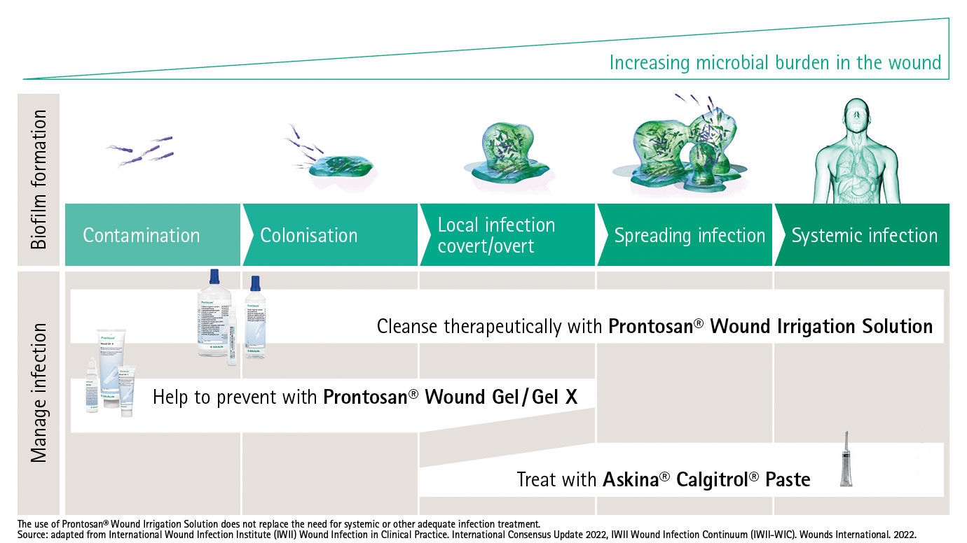 Graphic showing all stages of the wound infection continuum and treatment mit Prontosan and Askina Calgitrol