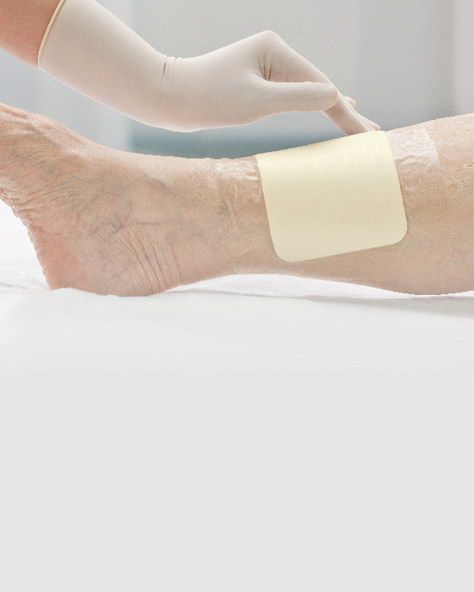 Leg ulcers