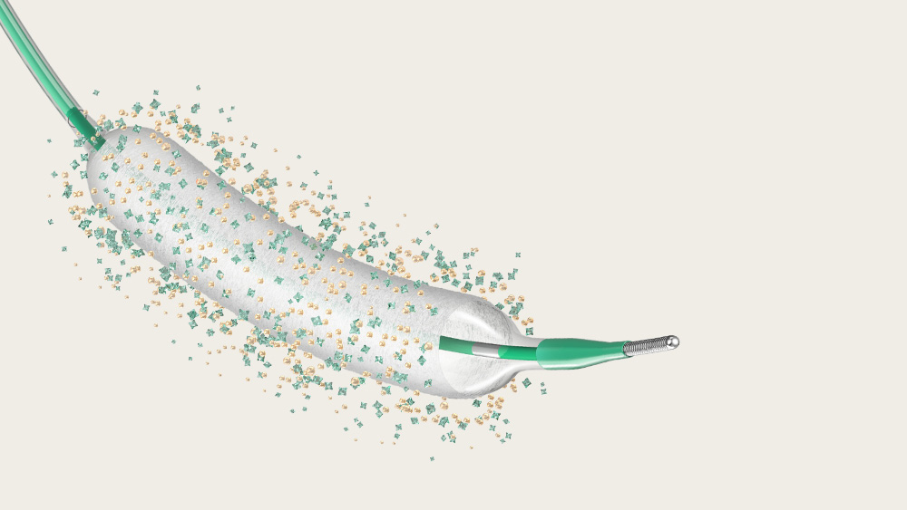 SeQuent® DCBs – Coronary Drug Coated Balloons - B. Braun