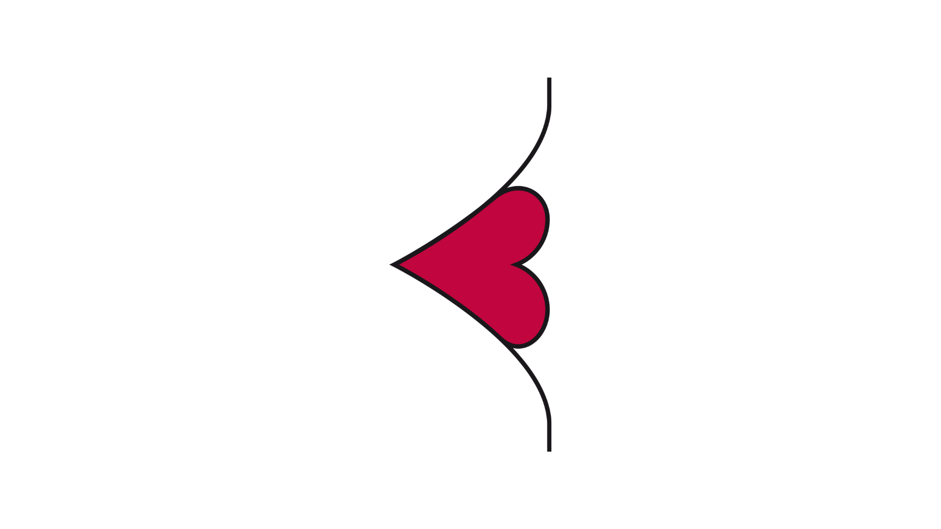 A profile illustration of a stoma where the surrounding abdominal skin curves deeply inward, creating a sharp, V-shaped crease or fold that pinches tightly around the red stoma tissue.