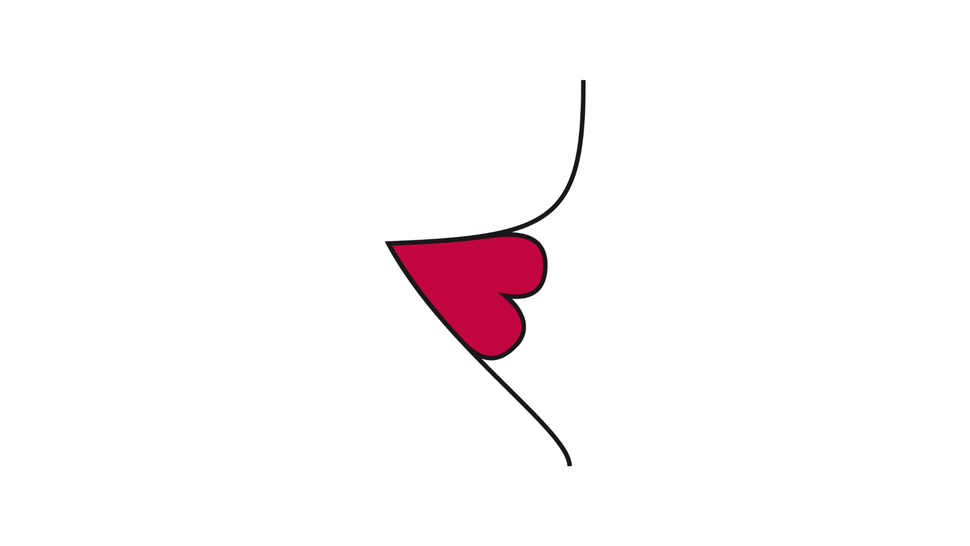 A profile illustration of a poorly placed stoma, where the abdominal skin line forms a sharp, uneven crease or fold, and the stoma is positioned awkwardly within this deep skin fold.