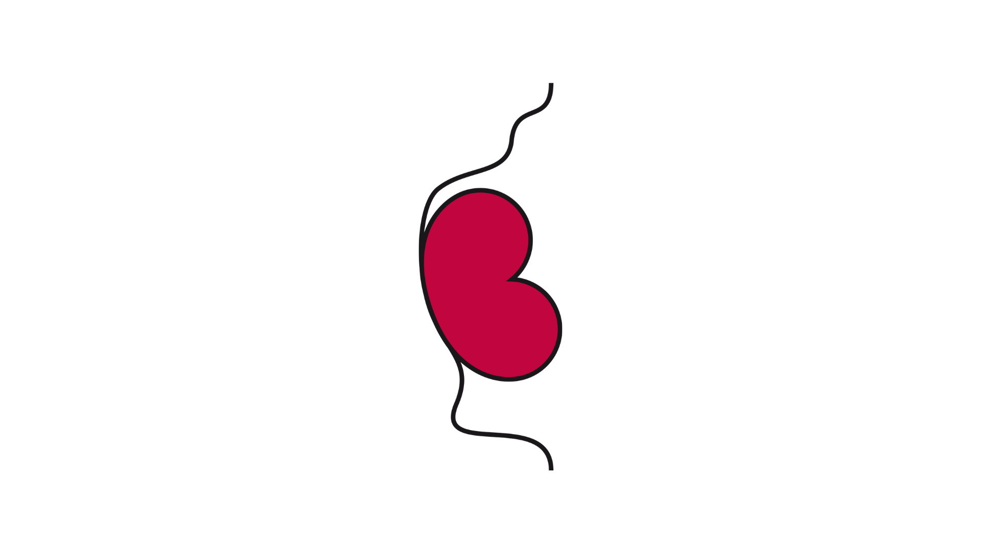 A profile illustration of a soft abdomen, showing a wavy, uneven line representing the abdominal wall bulging slightly outward, with the stoma following the soft, curved contours of the skin.